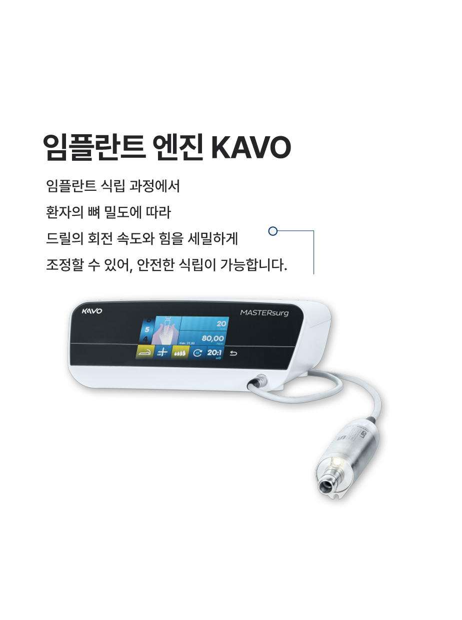 임플란트-엔진-KAVO